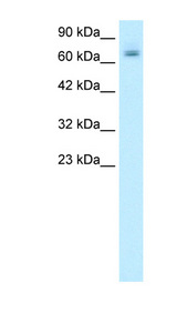 PARP2 antibody LS-B1553 Western blot of Raji lysate.