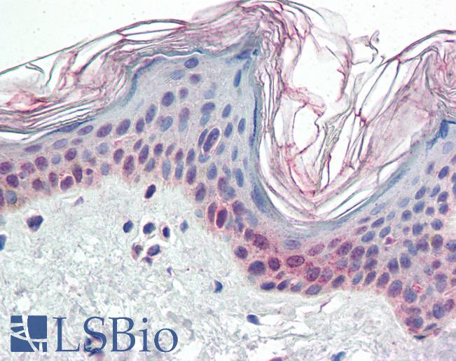 Anti-PARP2 antibody IHC of human skin. Immunohistochemistry of formalin-fixed, paraffin-embedded tissue after heat-induced antigen retrieval. Antibody LS-B3239 concentration 5 ug/ml.