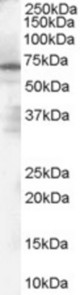 Antibody (1 ug/ml) staining of Human Spleen Lysate (35 ug protein in RIPA buffer). Primary incubation was 1 hour. Detected by chemiluminescence.