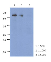 Western Blot: The cell lysate of HeLa (40 ug) were resolved by SDS-PAGE, transferred to PVDF membrane and probed with anti-human PARP2 antibody (1:500 ~ 1:5000). Proteins were visualized using a goat anti-mouse secondary antibody conjugated to HRP and an ECL detection system.