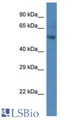PARP2 antibody Western Blot of MCF7. Antibody dilution: 1 ug/ml.