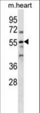 PARP2 Antibody western blot of mouse heart tissue lysates (35 ug/lane). The PARP2 antibody detected the PARP2 protein (arrow).