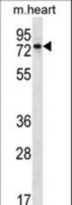 PARP2 Antibody western blot of mouse heart tissue lysates (35 ug/lane). The PARP2 antibody detected the PARP2 protein (arrow).