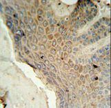 MFSD3 Antibody IHC of formalin-fixed and paraffin-embedded human skin tissue followed by peroxidase-conjugated secondary antibody and DAB staining.