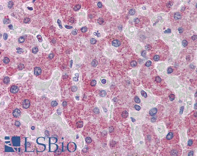 Anti-PARP3 antibody IHC of human liver. Immunohistochemistry of formalin-fixed, paraffin-embedded tissue after heat-induced antigen retrieval. Antibody LS-B4379 concentration 3.75 ug/ml.