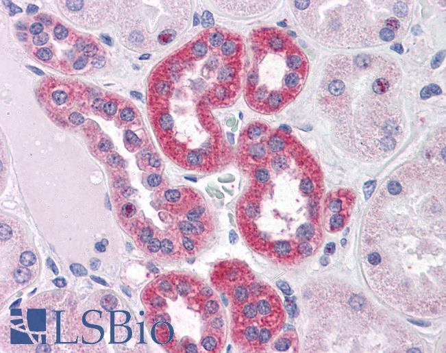 Anti-PARP3 antibody IHC of human kidney. Immunohistochemistry of formalin-fixed, paraffin-embedded tissue after heat-induced antigen retrieval. Antibody LS-B4379 concentration 3.75 ug/ml.