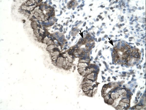 PARP3 antibody LS-C29728 was used in IHC to stain formalin-fixed, paraffin-embedded human stomach.