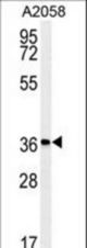 Western blot of MFSD3 Antibody in A2058 cell line lysates (35 ug/lane). MFSD3 (arrow) was detected using the purified antibody.