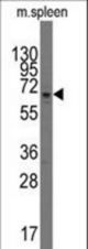 Western blot of anti-PARP3 antibody in mouse spleen tissue lysates (35 ug/lane). PARP3(arrow) was detected using the purified antibody.