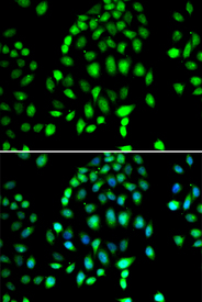 Immunofluorescence blot of MCF7 cell using PARP3 antibody. Blue: DAPI for nuclear staining.