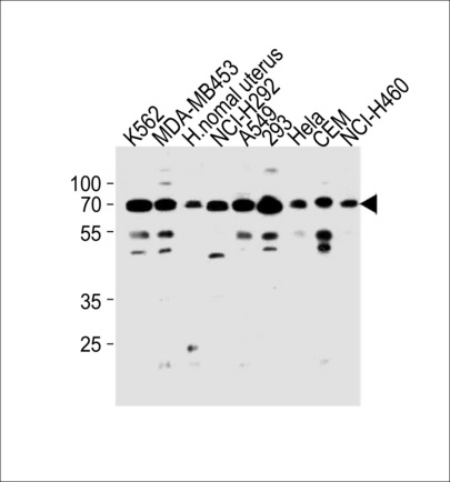 PARP3 Antibody western blot of K562,MDA-MB453,NCI-H292,A549,293,HeLa,CEM,NCI-H460 cell line and human normal uterus tissue lysates (35 ug/lane). The PARP3 antibody detected the PARP3 protein (arrow).