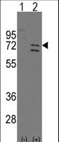 Western blot of Parp6 (arrow) using rabbit polyclonal Parp6 Antibody. 293 cell lysates (2 ug/lane) either nontransfected (Lane 1) or transiently transfected with the Parp6 gene (Lane 2) (Origene Technologies).