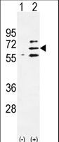 Western blot of Parp6 (arrow) using rabbit polyclonal Parp6 Antibody. 293 cell lysates (2 ug/lane) either nontransfected (Lane 1) or transiently transfected (Lane 2) with the Parp6 gene.