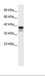 Daudi Cell Lysate