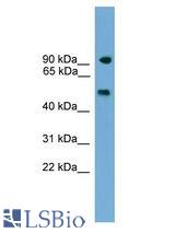 PARP8 antibody Western Blot of Mouse Thymus.