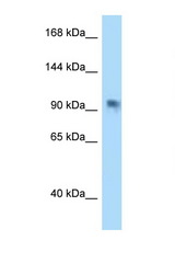 PARP8 antibody LS-C146029 Western blot of HeLa Cell lysate. Antibody concentration 1 ug/ml.