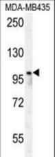 PARP8 Antibody western blot of MDA-MB435 cell line lysates (35 ug/lane). The PARP8 antibody detected the PARP8 protein (arrow).