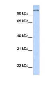 PARP9 antibody LS-C101464 Western blot of Fetal Brain lysate.