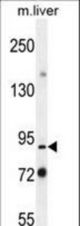 Parp9 Antibody western blot of mouse liver tissue lysates (35 ug/lane). The Parp9 antibody detected the Parp9 protein (arrow).