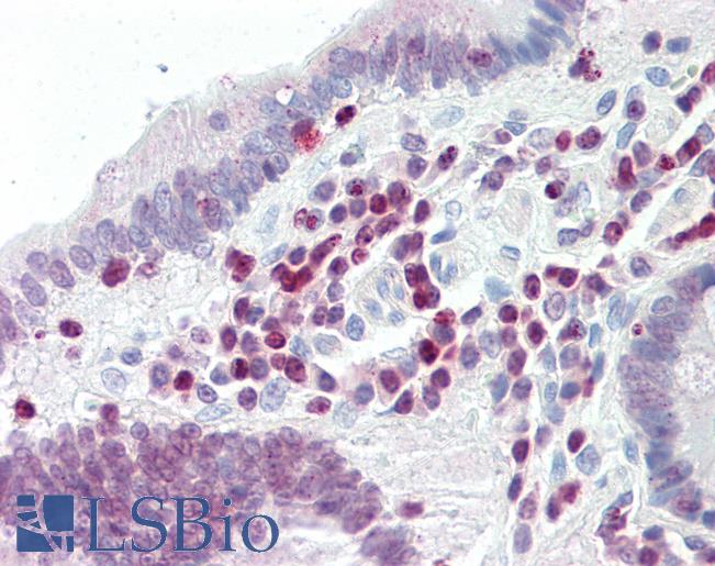 Anti-PARP9 antibody IHC staining of human small intestine. Immunohistochemistry of formalin-fixed, paraffin-embedded tissue after heat-induced antigen retrieval.