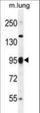 Parp9 Antibody western blot of mouse lung tissue lysates (35 ug/lane). The Parp9 antibody detected the Parp9 protein (arrow).