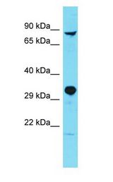 PARPBP / C12orf48 antibody Western Blot of Fetal Heart. Antibody dilution: 1 ug/ml.
