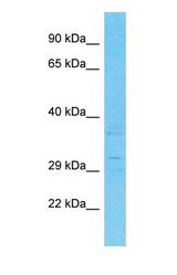 Western blot of PARPBP Antibody with human HeLa Whole Cell lysate.