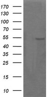 HEK293T cells were transfected with the pCMV6-ENTRY control (Left lane) or pCMV6-ENTRY PARVA (Right lane) cDNA for 48 hrs and lysed. Equivalent amounts of cell lysates (5 ug per lane) were separated by SDS-PAGE and immunoblotted with anti-PARVA.