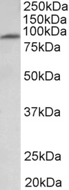 MFSD6 antibody (1 ug/ml) staining of Human Heart lysate (35 ug protein in RIPA buffer). Primary incubation was 1 hour. Detected by chemiluminescence.