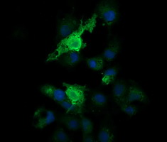 Anti-PARVA mouse monoclonal antibody immunofluorescent staining of COS7 cells transiently transfected by pCMV6-ENTRY PARVA.