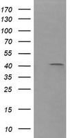 HEK293T cells were transfected with the pCMV6-ENTRY control (Left lane) or pCMV6-ENTRY PARVA (Right lane) cDNA for 48 hrs and lysed. Equivalent amounts of cell lysates (5 ug per lane) were separated by SDS-PAGE and immunoblotted with anti-PARVA.