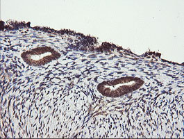IHC of paraffin-embedded Human endometrium tissue using anti-PARVA mouse monoclonal antibody.