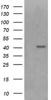 HEK293T cells were transfected with the pCMV6-ENTRY control (Left lane) or pCMV6-ENTRY PARVA (Right lane) cDNA for 48 hrs and lysed. Equivalent amounts of cell lysates (5 ug per lane) were separated by SDS-PAGE and immunoblotted with anti-PARVA.