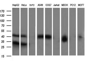 Western blot of extracts (35 ug) from 9 different cell lines by using anti-PARVA monoclonal antibody (HepG2: human; HeLa: human; SVT2: mouse; A549: human; COS7: monkey; Jurkat: human; MDCK: canine; PC12: rat; MCF7: human).
