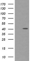HEK293T cells were transfected with the pCMV6-ENTRY control (Left lane) or pCMV6-ENTRY PARVA (Right lane) cDNA for 48 hrs and lysed. Equivalent amounts of cell lysates (5 ug per lane) were separated by SDS-PAGE and immunoblotted with anti-PARVA.