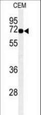 Western blot of MFSD6 Antibody in CEM cell line lysates (35 ug/lane). MFSD6 (arrow) was detected using the purified antibody.