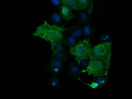 Anti-PARVA mouse monoclonal antibody immunofluorescent staining of COS7 cells transiently transfected by pCMV6-ENTRY PARVA.