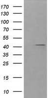 HEK293T cells were transfected with the pCMV6-ENTRY control (Left lane) or pCMV6-ENTRY PARVA (Right lane) cDNA for 48 hrs and lysed. Equivalent amounts of cell lysates (5 ug per lane) were separated by SDS-PAGE and immunoblotted with anti-PARVA.