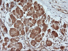 IHC of paraffin-embedded Human pancreas tissue using anti-PARVA mouse monoclonal antibody.