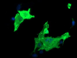 Anti-PARVA mouse monoclonal antibody immunofluorescent staining of COS7 cells transiently transfected by pCMV6-ENTRY PARVA.