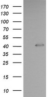 HEK293T cells were transfected with the pCMV6-ENTRY control (Left lane) or pCMV6-ENTRY PARVA (Right lane) cDNA for 48 hrs and lysed. Equivalent amounts of cell lysates (5 ug per lane) were separated by SDS-PAGE and immunoblotted with anti-PARVA.