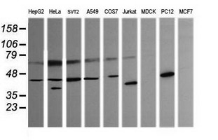 Western blot of extracts (35 ug) from 9 different cell lines by using anti-PARVA monoclonal antibody (HepG2: human; HeLa: human; SVT2: mouse; A549: human; COS7: monkey; Jurkat: human; MDCK: canine; PC12: rat; MCF7: human).
