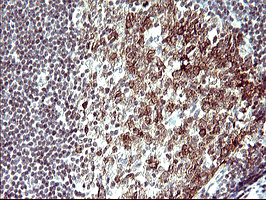 IHC of paraffin-embedded Human lymph node tissue using anti-PARVA mouse monoclonal antibody. (Heat-induced epitope retrieval by 10mM citric buffer, pH6.0, 120°C for 3min).