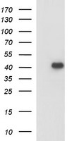 HEK293T cells were transfected with the pCMV6-ENTRY control (Left lane) or pCMV6-ENTRY PARVA (Right lane) cDNA for 48 hrs and lysed. Equivalent amounts of cell lysates (5 ug per lane) were separated by SDS-PAGE and immunoblotted with anti-PARVA.