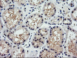 IHC of paraffin-embedded Human Kidney tissue using anti-PARVA mouse monoclonal antibody. (Heat-induced epitope retrieval by 10mM citric buffer, pH6.0, 120°C for 3min).