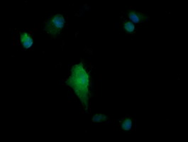 Anti-PARVA mouse monoclonal antibody immunofluorescent staining of COS7 cells transiently transfected by pCMV6-ENTRY PARVA.