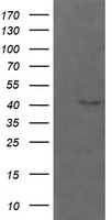 HEK293T cells were transfected with the pCMV6-ENTRY control (Left lane) or pCMV6-ENTRY PARVA (Right lane) cDNA for 48 hrs and lysed. Equivalent amounts of cell lysates (5 ug per lane) were separated by SDS-PAGE and immunoblotted with anti-PARVA.