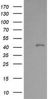 HEK293T cells were transfected with the pCMV6-ENTRY control (Left lane) or pCMV6-ENTRY PARVA (Right lane) cDNA for 48 hrs and lysed. Equivalent amounts of cell lysates (5 ug per lane) were separated by SDS-PAGE and immunoblotted with anti-PARVA.