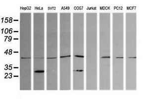 Western blot of extracts (35 ug) from 9 different cell lines by using anti-PARVA monoclonal antibody (HepG2: human; HeLa: human; SVT2: mouse; A549: human; COS7: monkey; Jurkat: human; MDCK: canine; PC12: rat; MCF7: human).