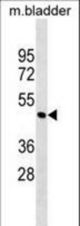 Mouse Parva Antibody western blot of mouse bladder tissue lysates (35 ug/lane). The Parva antibody detected the Parva protein (arrow).